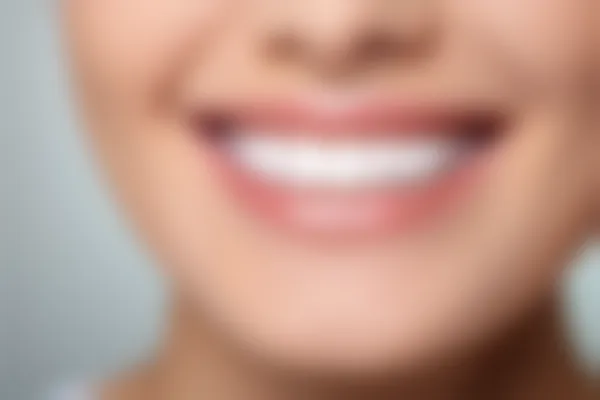 特价全瓷牙冠真的可以使用吗？了解其质量与结果的相关信息