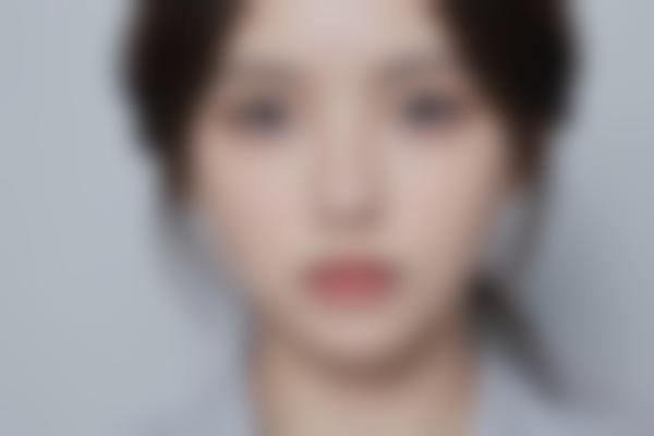 罗定面部轮廓重塑哪家强？这份正规医美机构攻略请收好