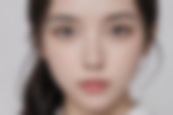 佳木斯正规五官手术医院选择指南