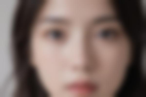 轮廓手术如何选择医院？这份指南请收好