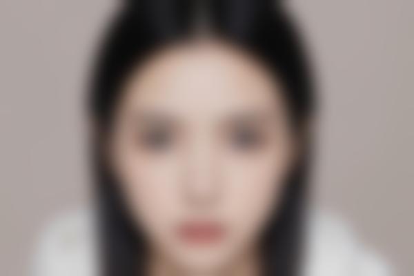 矫正乳头手术是怎么回事？需要了解的都在这儿