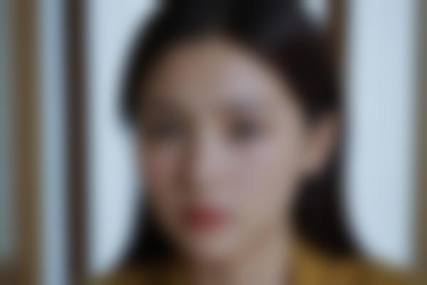 FUE无痕植发收费标准及技术优势详解