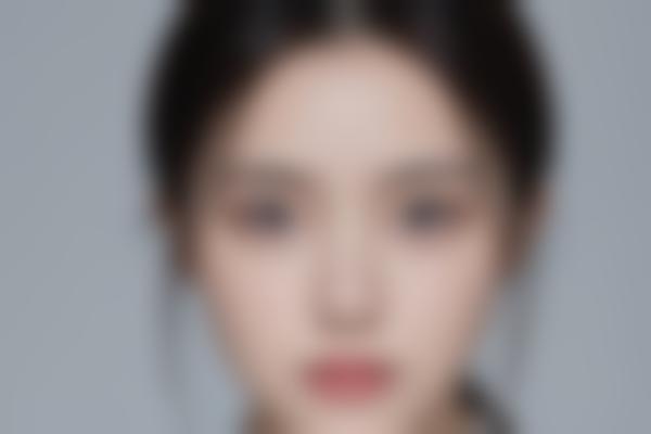 提臀手术怎么样？了解手术方式、与注意事项
