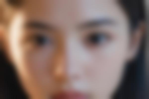 南宁爱思特整形医院痤疮治疗正规吗
