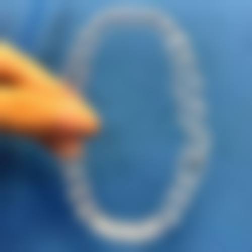 牙齿矫正项目特色