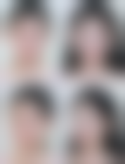 诊疗特色总结 - 深圳唯美星医疗美容门诊部涂林医生