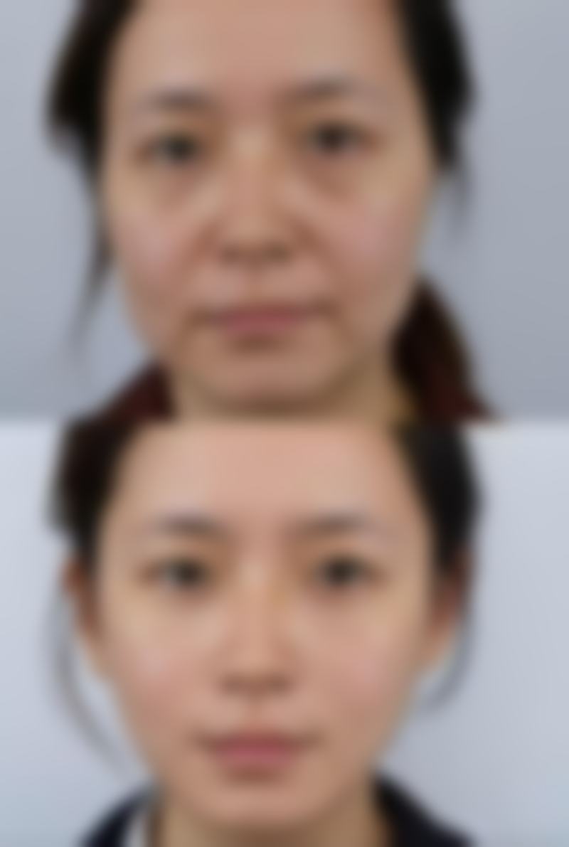 临床实例分享 諸瑞眞