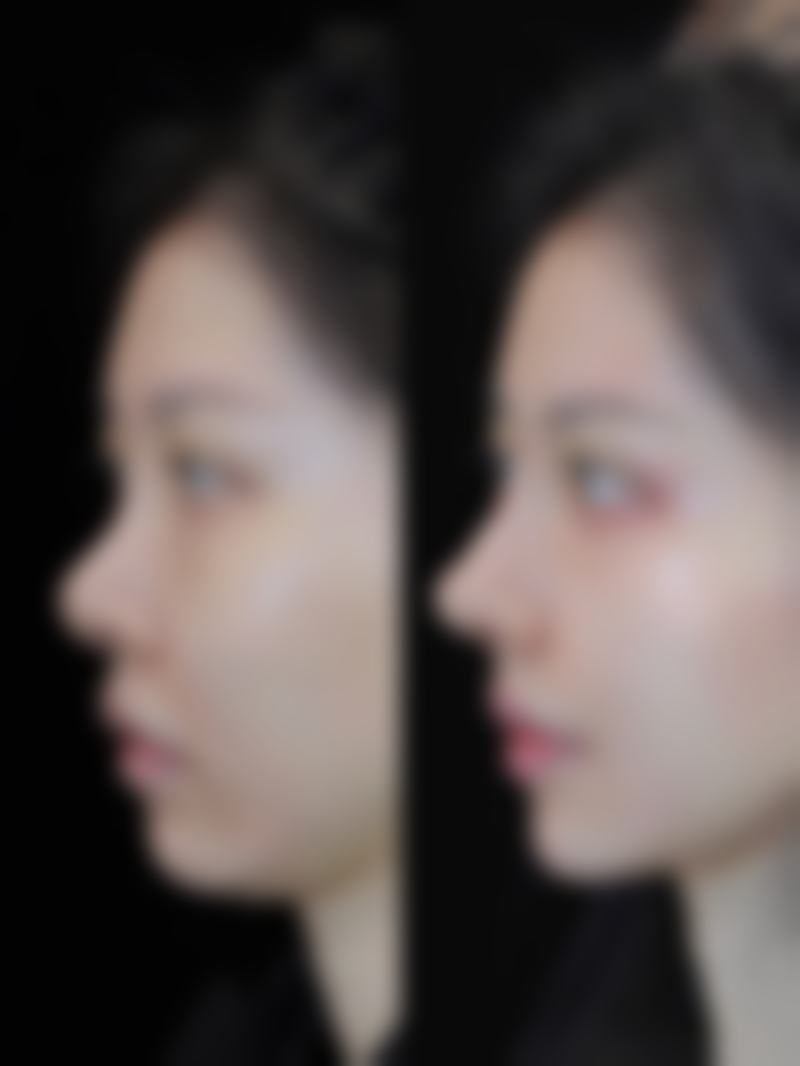 优惠活动详情