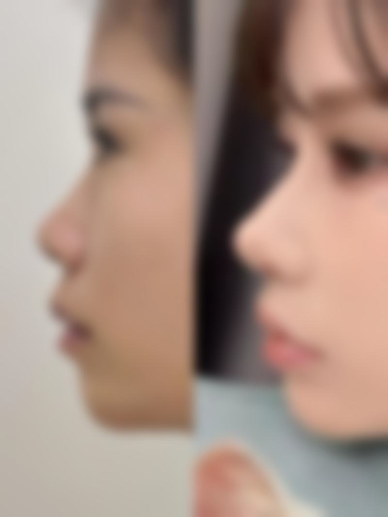 优惠活动详情
