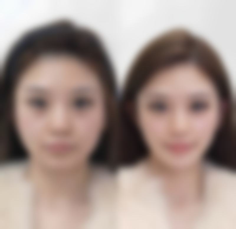结尾预约号召 - 再次强调医生优势与优惠