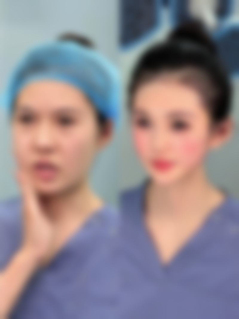 优惠活动详情