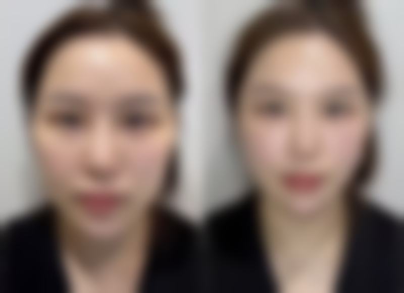 擅长项目详解