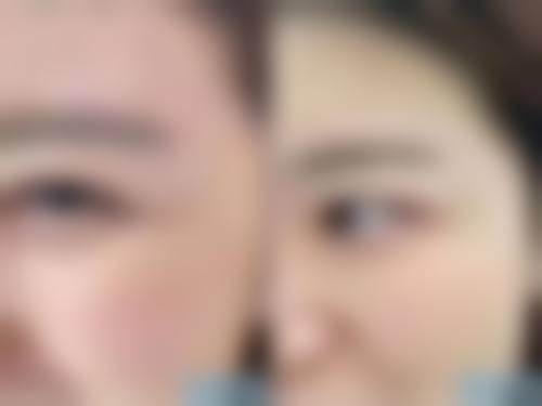 临床实例分享