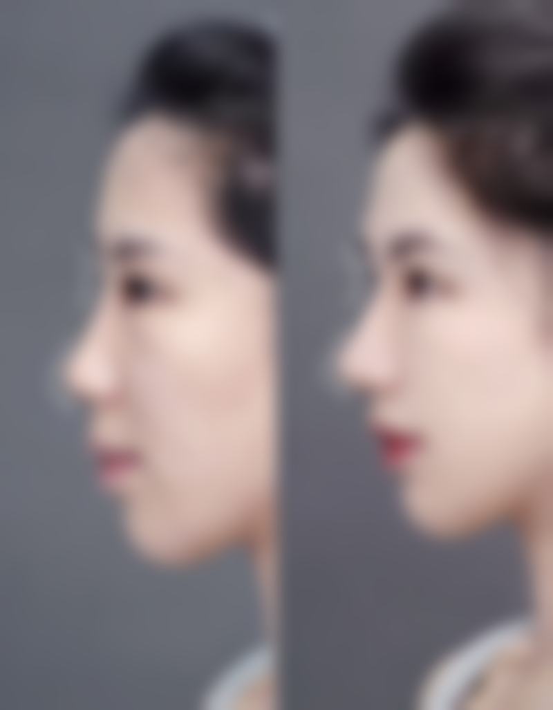 预约优惠活动
