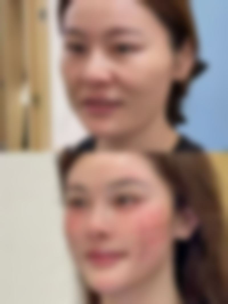 优惠活动详情