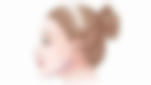 临床实例分享