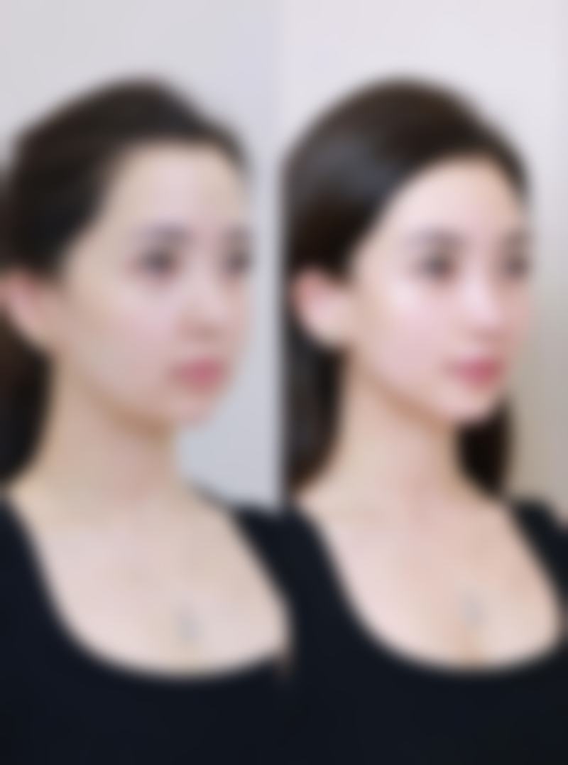 优惠活动详情