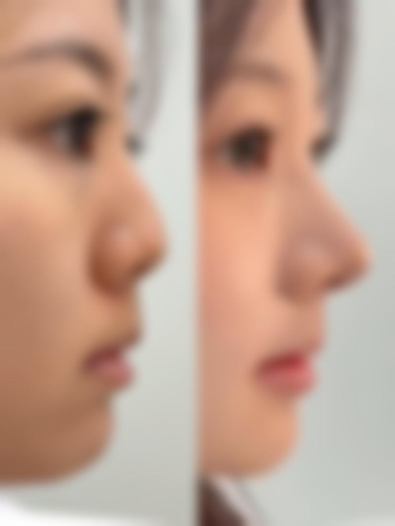 患者真实评价