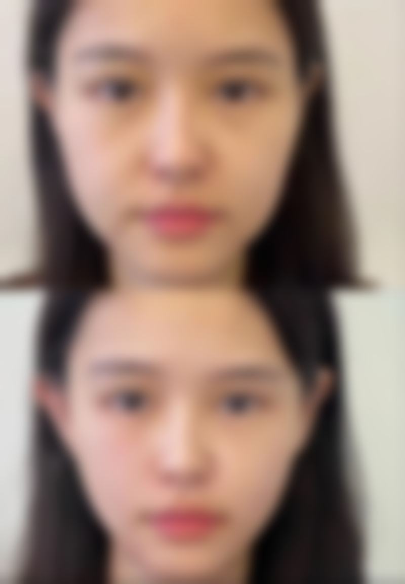 优惠活动详情
