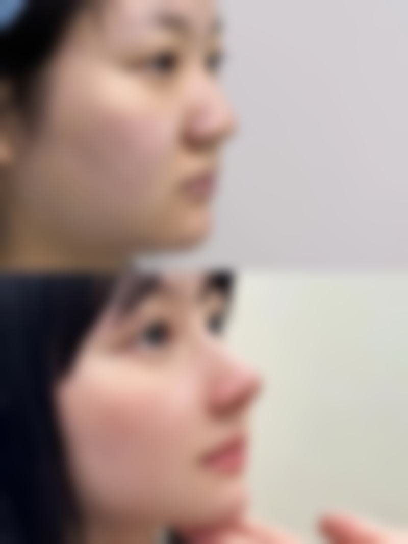 预约优惠活动