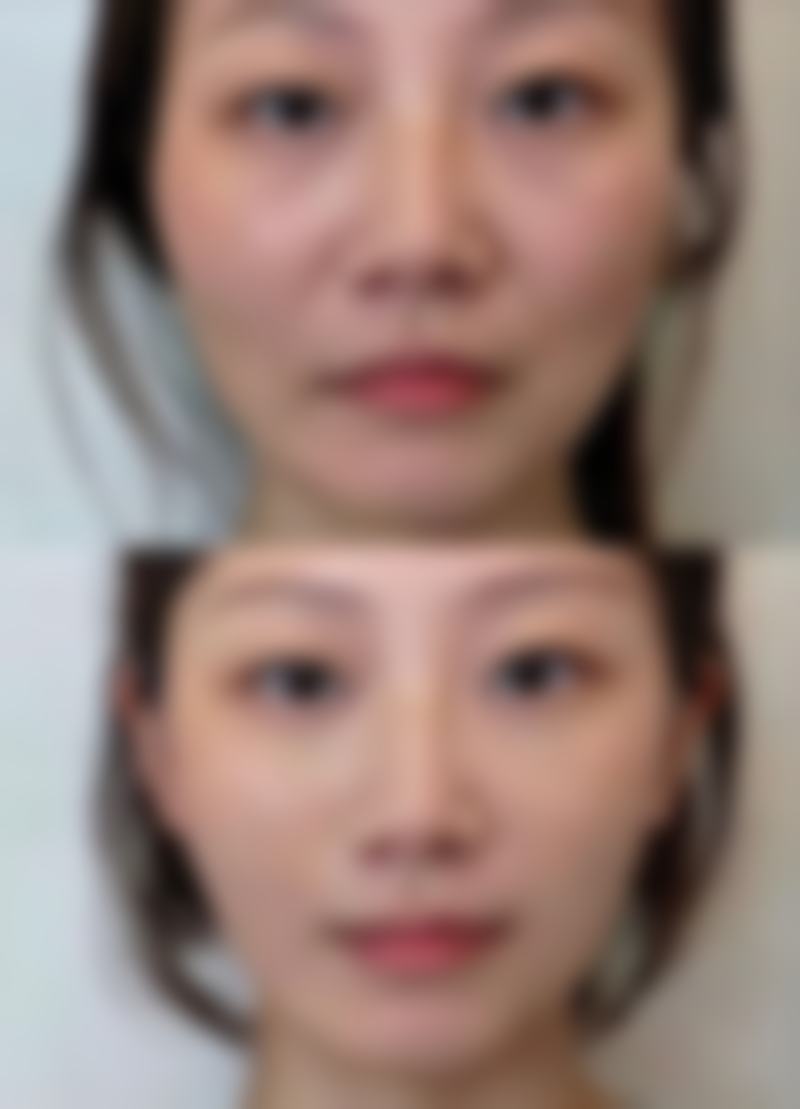 预约优惠活动