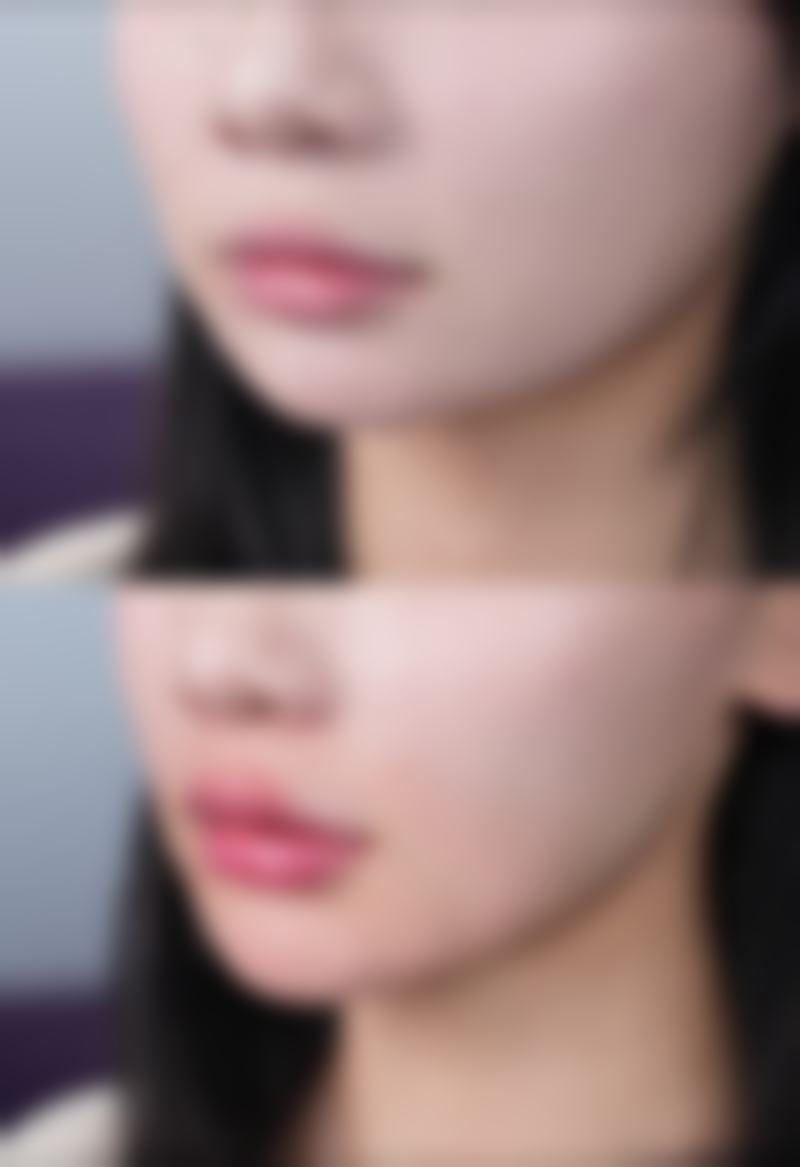 临床实例分享