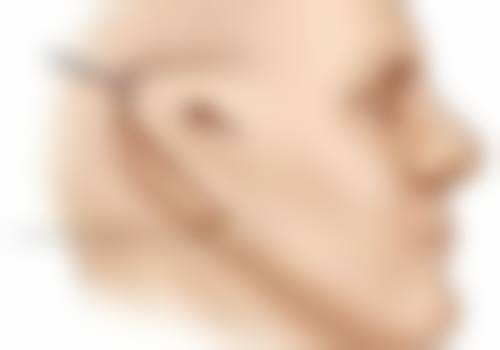 患者真实评价