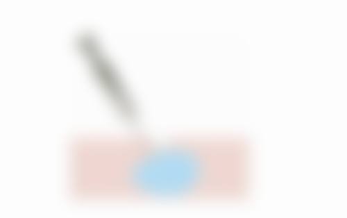 擅长项目详解