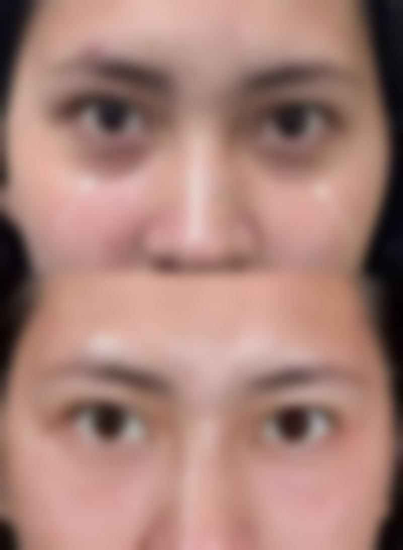 优惠活动详情