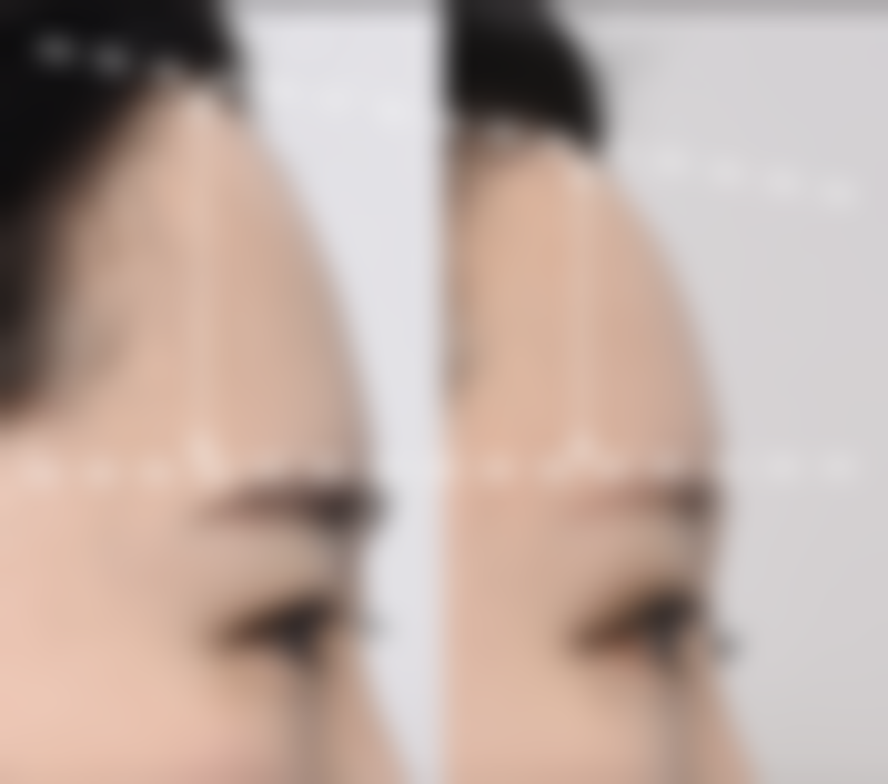 擅长项目详解
