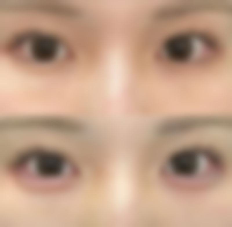 优惠活动详情