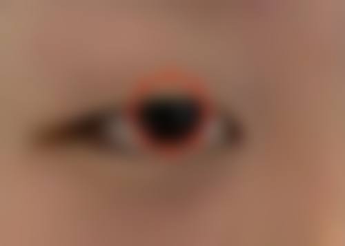 擅长项目详解