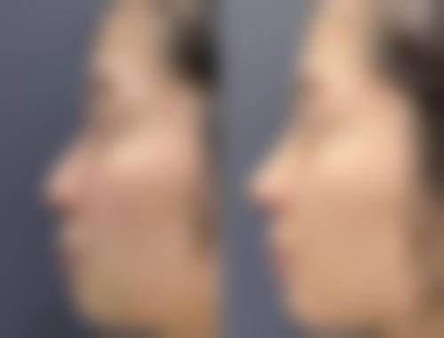 优惠活动详情