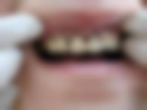 宁波好牙口腔诊所患者真实口碑评价