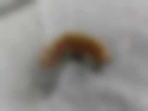 王朦运用数字化技术提升诊疗精细度