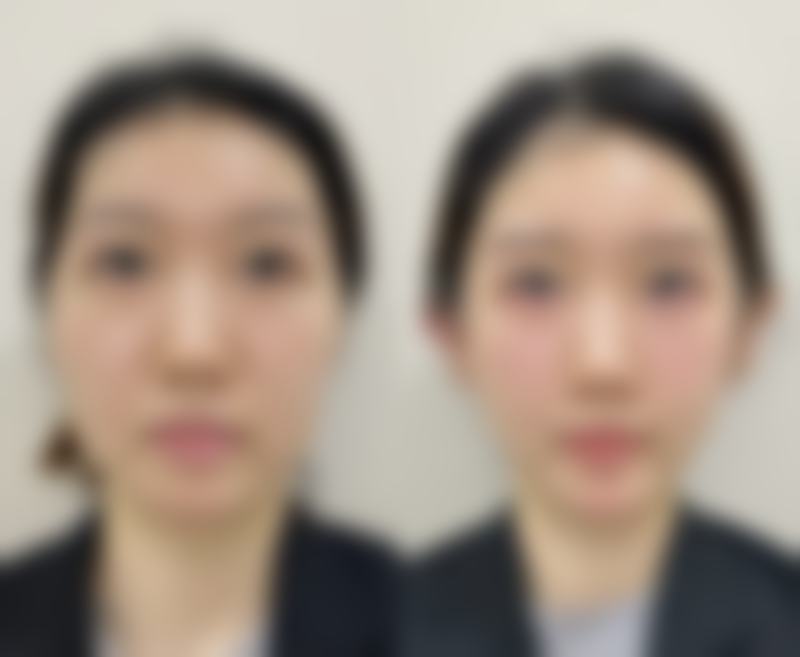 沈阳和平李淼整形医院&李淼口碑评价真实
