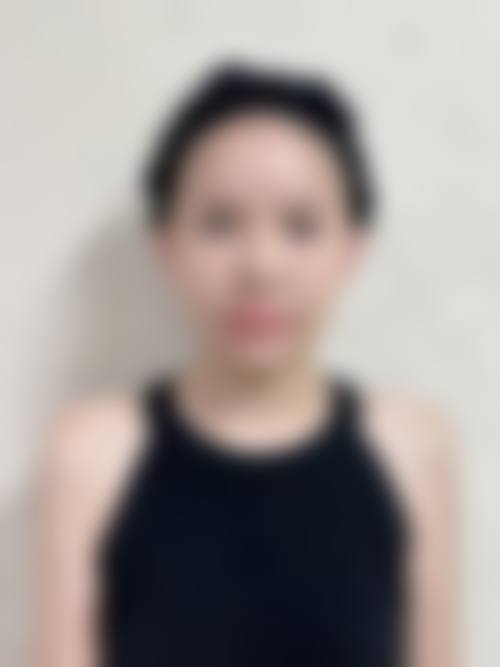 丹东金澄整形美容医院&紫良口碑评价