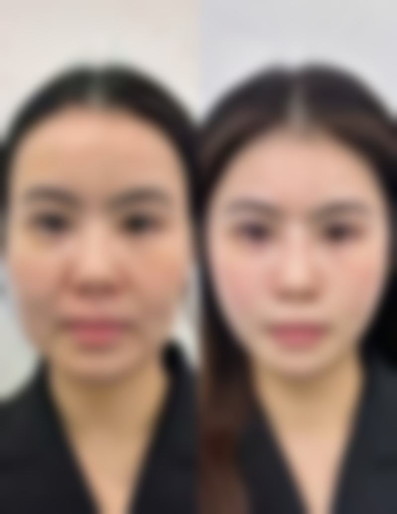 武汉美都医疗美容门诊部&张召口碑评价