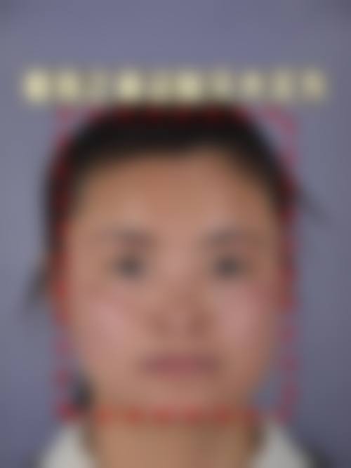 宁波高新区嘉莱美整形医院乘车路线导航指引