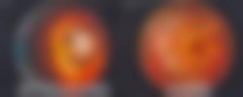 桂林爱尔眼科医院专注屈光与白内障特色诊疗
