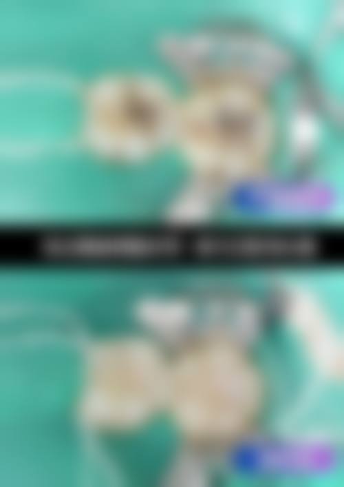 程其亮医生真实患者口碑评价汇总