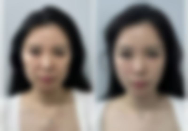 聊城韩美整形美容医院乘车路线指南