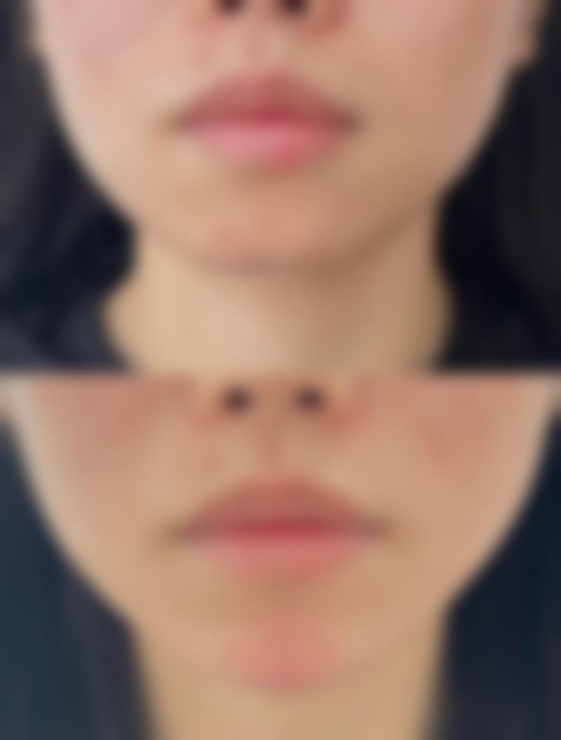 牡丹江邹倩医疗美容诊所&邹倩口碑评价